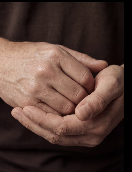 Hands after — restored, hydrated skin barrier